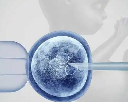 聚缘助孕包成功套餐_赴泰国试管婴儿选择性别费用