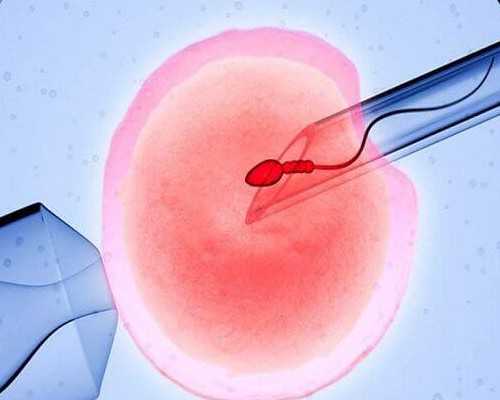 试管婴儿或者代孕的孕妈妈为什么会去做亲子鉴定？