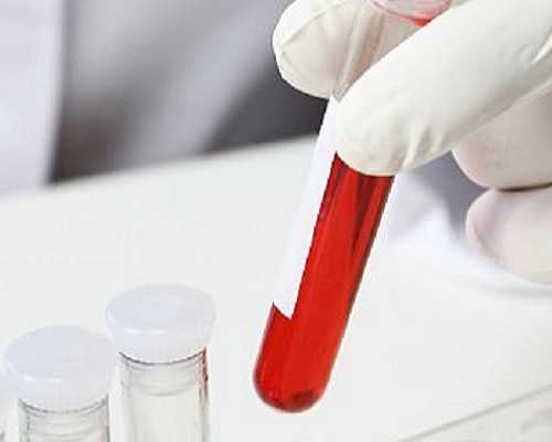 北京妇幼保健院可以申请供卵做试管么？,郑州助孕机构排名(北京供卵机构有哪