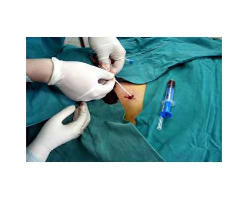 北京助孕生子代生医院|宣城三代试管包生男孩价格2026
北京