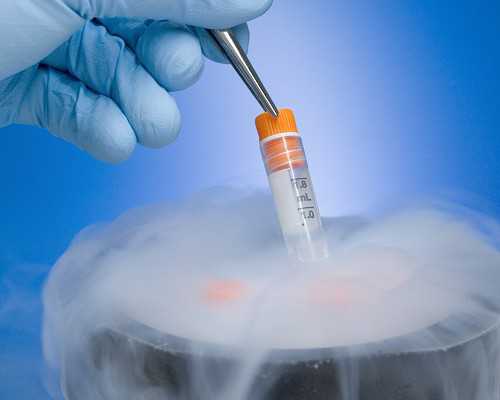 北京妇产医院冻胚续费 北京东方医院生殖医学中心 ‘三维彩超男女’